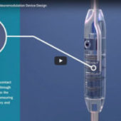 Medical Electrical Connectors in Neuromodulation Devices