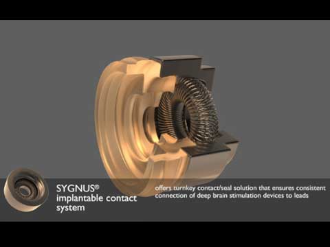 Deep Brain Stimulation Device With SYGNUS System