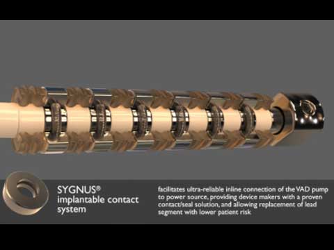 SYGNUS for Lead Connections in VAD