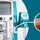 Dialysis Machine Design Success Factors: Sealing