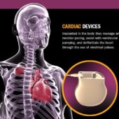 Cardiac Device Design Infographic
