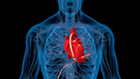 Low Resistance, Low Heat Rise Contacts for Heart Assist Devices