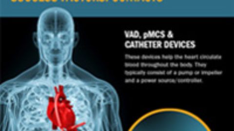 Infographic: Heart Assist Device Design