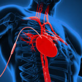 Video: Contacts for heart assist device design