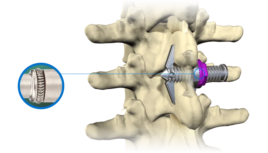 Bal Seal Medical Devices Spinal Device