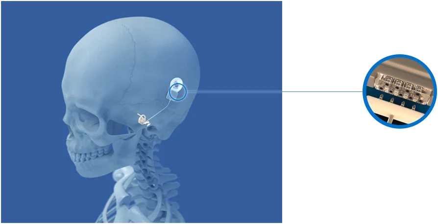 Bal Seal Bal Conn Electrical Contact Cochlear