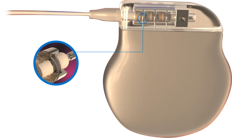electrical contact applications for cardiac heart failure