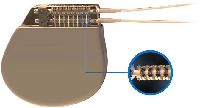 scs device