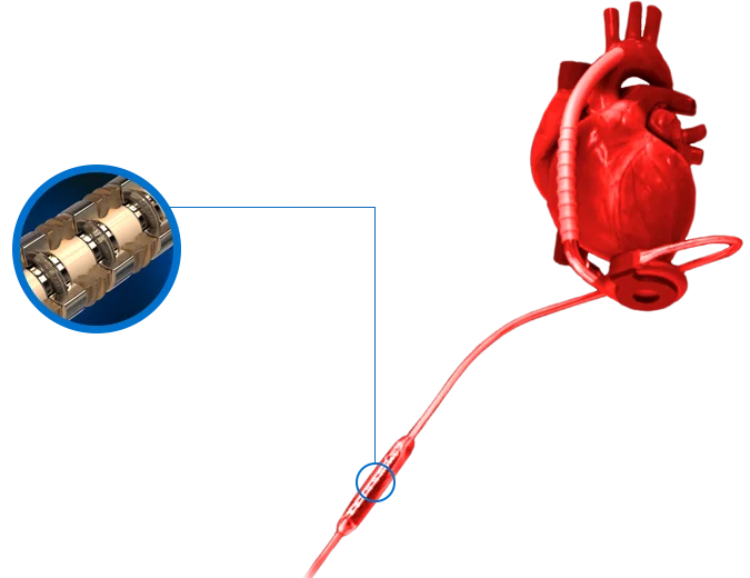 Bal Seal Medical Devices Ventricular Assist Device